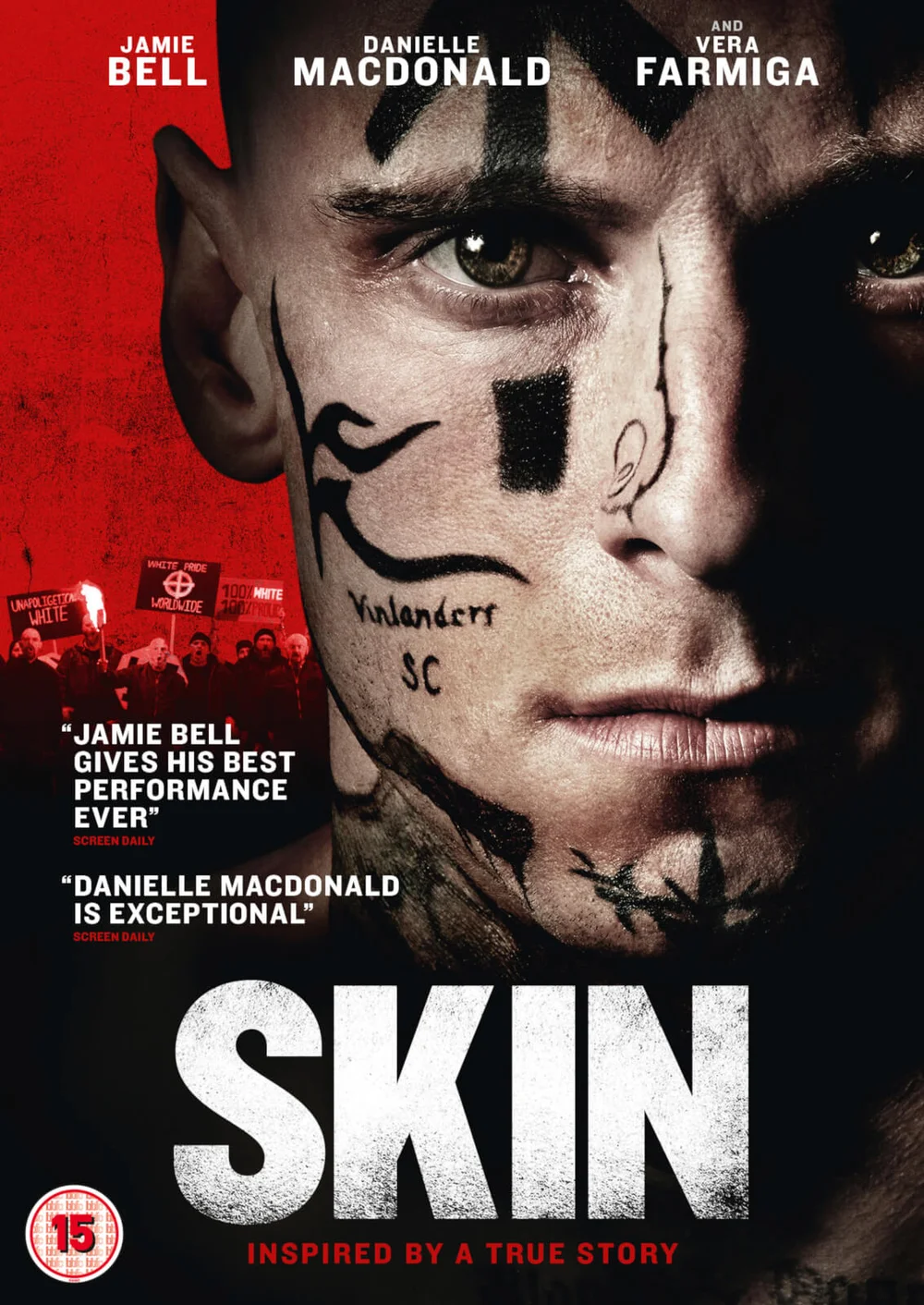 Skin Image 1