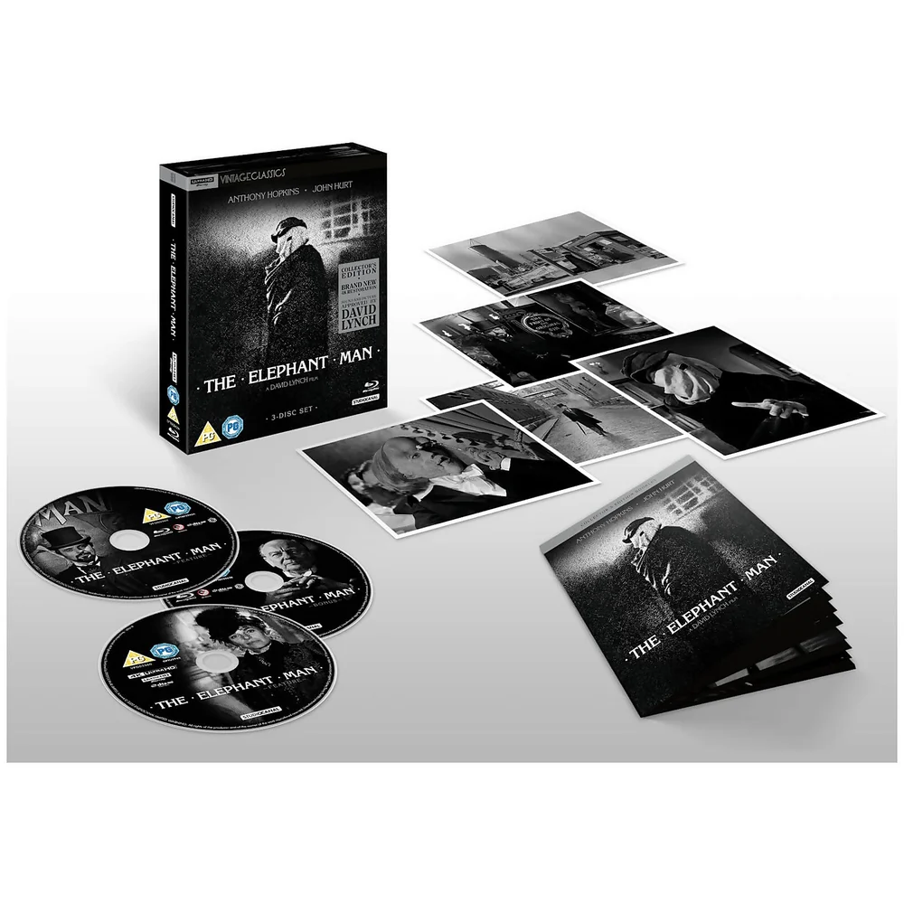 The Elephant Man (Édition 40e anniversaire) - Édition collector Image 1